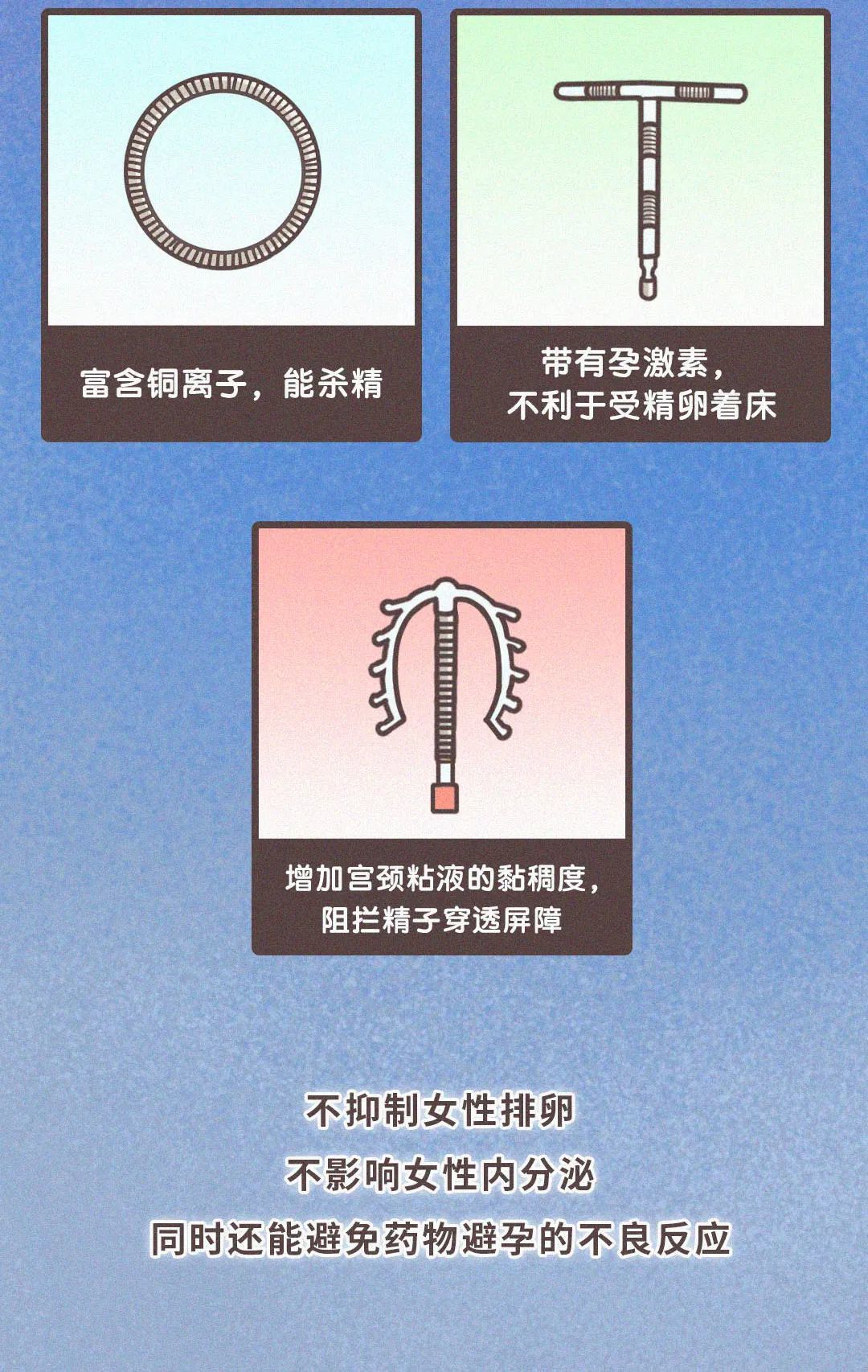 节育环b超图片图片