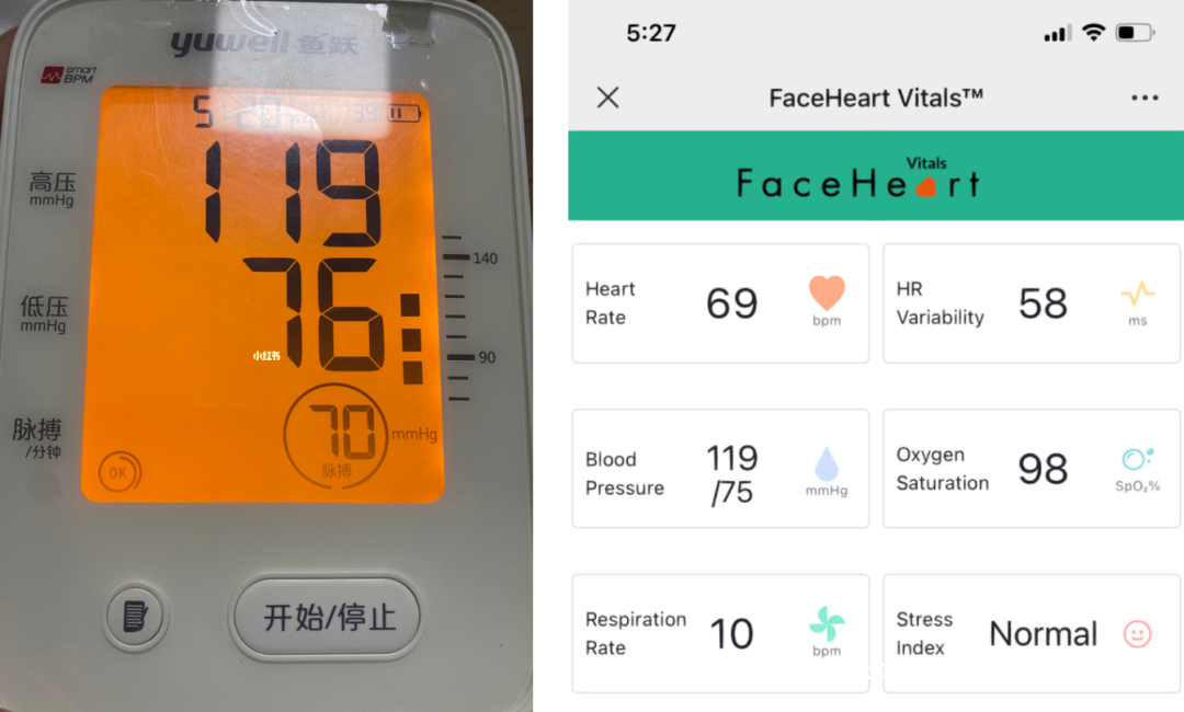 血氧仪是什么产品没有血氧仪？这个产品打开手机摄像头就能测_https://www.jmylbn.com_新闻资讯_第11张