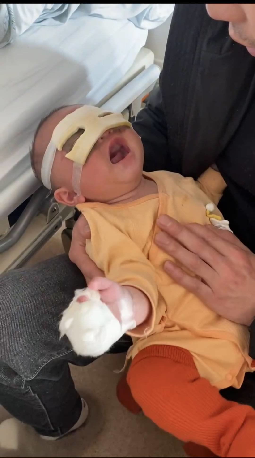 小语禾的眼睛和手多处烧伤。