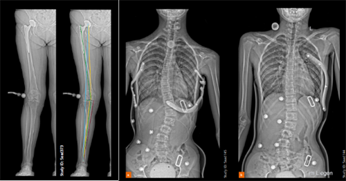 x光机可以检查什么X光机的新征途：启幕立位三维影像时代_https://www.jmylbn.com_新闻资讯_第2张