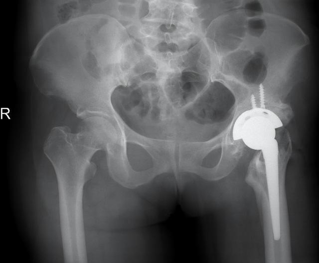 ▲患者术前术后影像资料