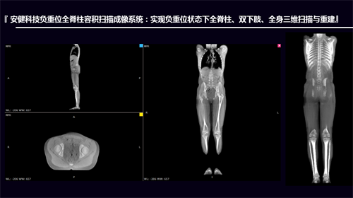 x光机可以检查什么X光机的新征途：启幕立位三维影像时代_https://www.jmylbn.com_新闻资讯_第4张