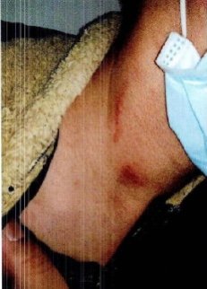 被害人伤势。 本文图片均为上海市青浦区检察院 供图