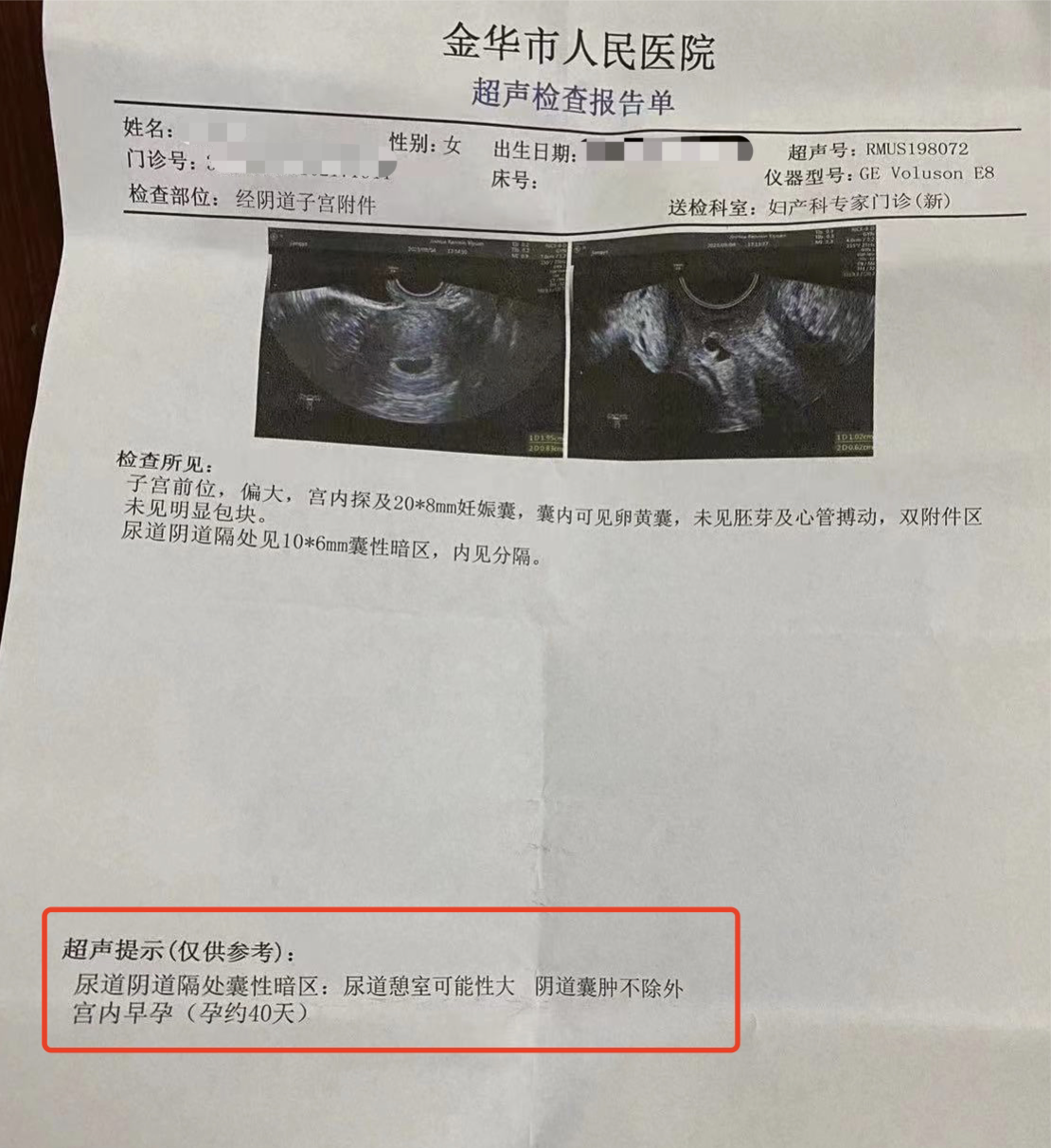 金华市人民医院诊断怀孕约40天。
