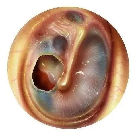 鼓膜穿孔是小问题？成都民生耳鼻喉医院专家提醒：严重可导致耳聋！国家三级专科医院