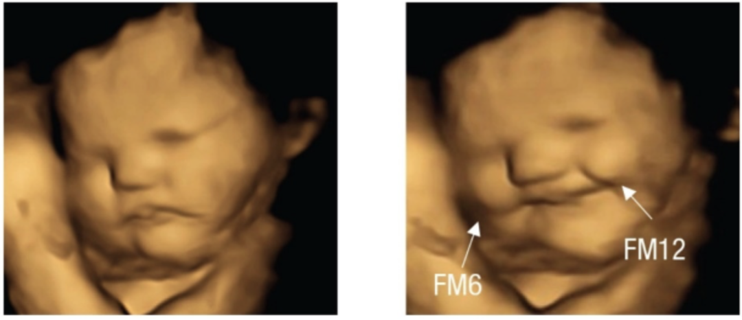 左为正常情况下胎儿的表情,右为胡萝卜组宝宝的笑脸表情。