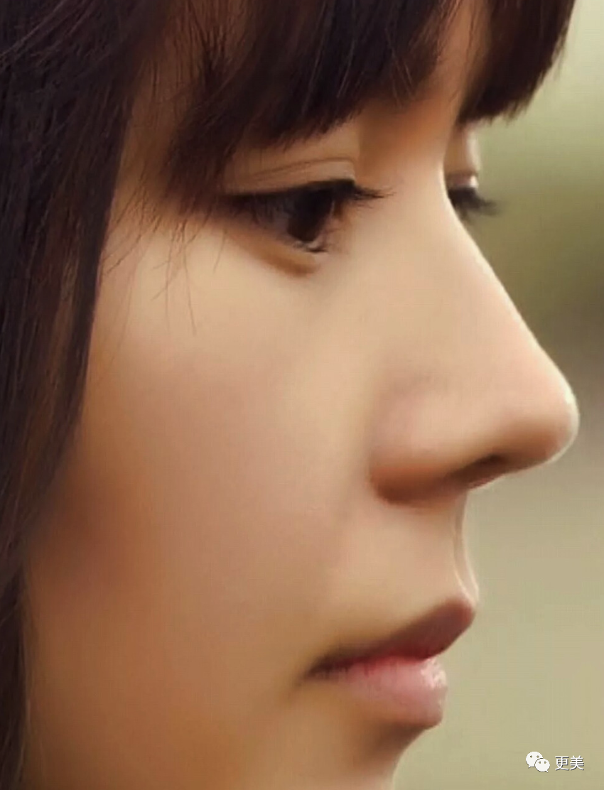 Alison Wee - 🌸童颜脸一般都拥有饱满、柔和协调的脸部👶 让人看起来比实际年龄要小很多😘  以下这些“童颜脸”特征如果你有的话，长相应该很甜美哦❗ 弯弯的笑眼极具亲和力，很有邻家女生的feel哦🙆 ㊙童颜秘籍首要条件: ①巴掌脸🖐🏼  ②苹果肌饱满, image size:850x1112