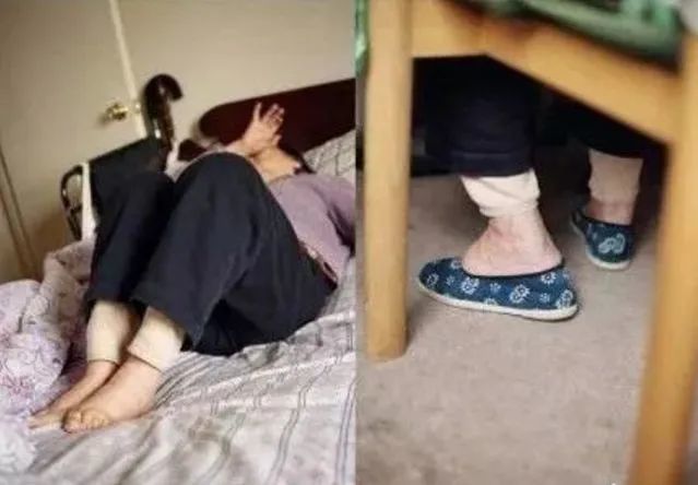 高耀洁的“三寸金莲”