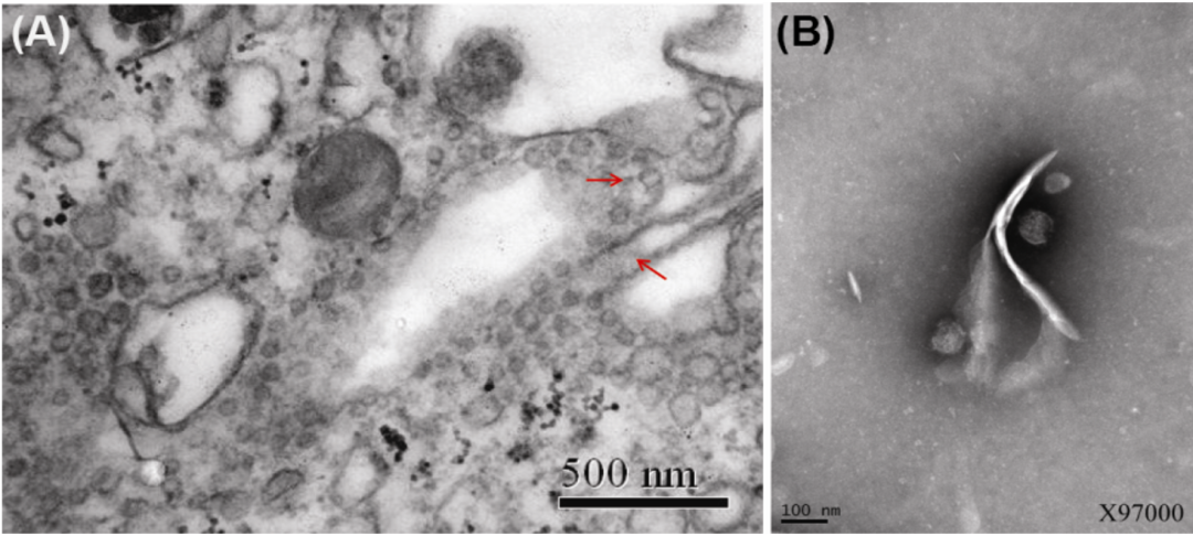 病毒学家张永振:未来5年还会不会出现新发突发传染病?可能规模不会像新冠这么大,但出现是必然