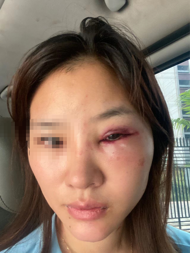 90后福建女子柬埔寨遭性侵殴打，装顺从逃出报警，至今被威胁“不翻供就报复”