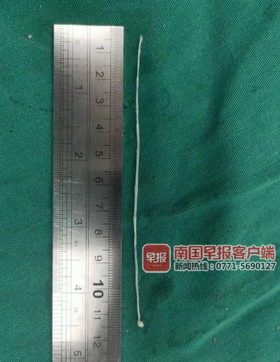 11厘米足足有这么长!