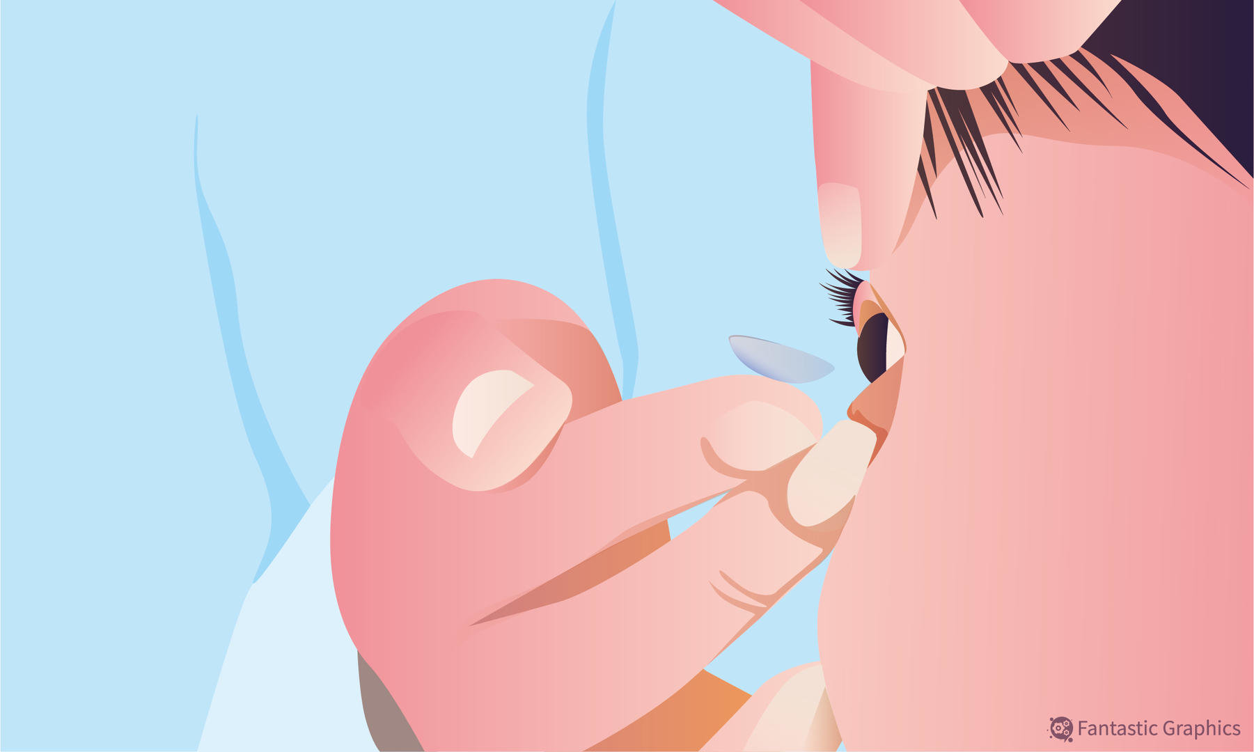 眼科耗材怎么分类OK镜首次集采降价幅度有限，眼科专家：对耗材成本、服务费影响不大_https://www.jmylbn.com_新闻资讯_第1张