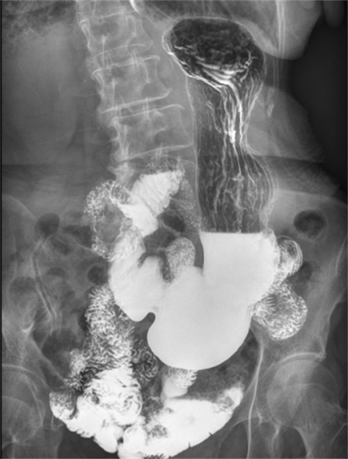 x射线为什么叫dr2023年新技术浪潮下的DR技术趋势_https://www.jmylbn.com_新闻资讯_第2张