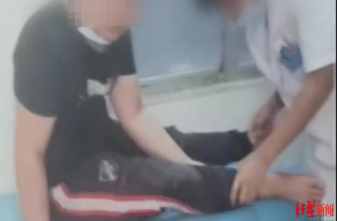 ▲阿飞逃出公司后,右脚受伤,被带到缅北当地一家医院治疗