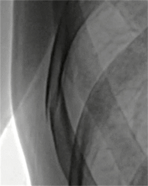 x射线为什么叫dr2023年新技术浪潮下的DR技术趋势_https://www.jmylbn.com_新闻资讯_第1张