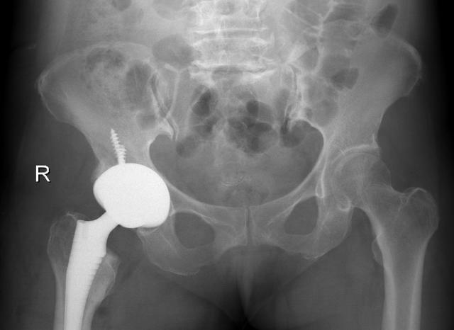 ▲术后影像资料