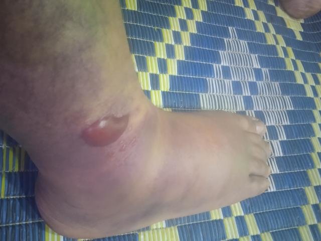 身家千万旅游公司老板被绑架到缅甸做诈骗,几经转手,暴瘦50斤;2022年最后一天称被保释,即将回家