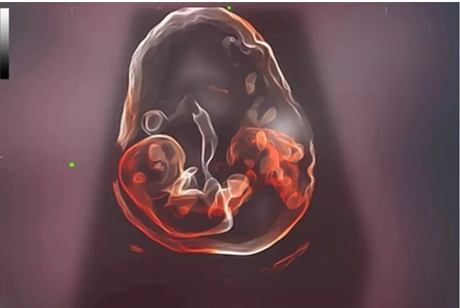 迈瑞有什么产品迈瑞医疗多款高端产品应用AI黑科技_https://www.jmylbn.com_新闻资讯_第1张