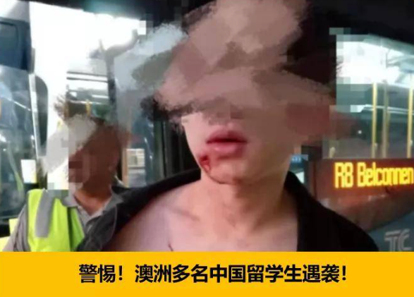 “该死的亚洲脸!”中国留学生除夕夜遇袭,遭辱骂推搡!使馆发提醒