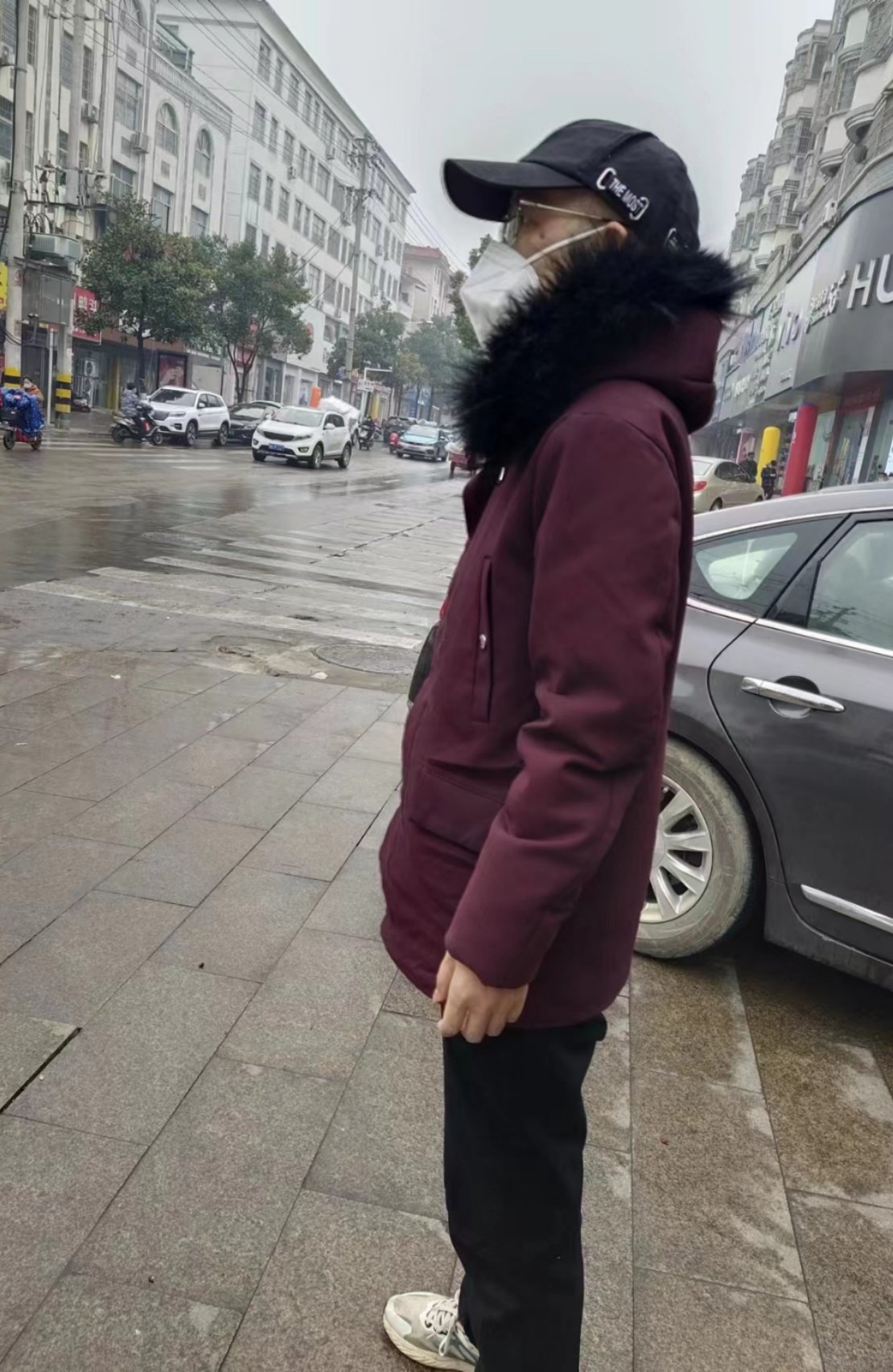 手术后仍在排异期的李晖