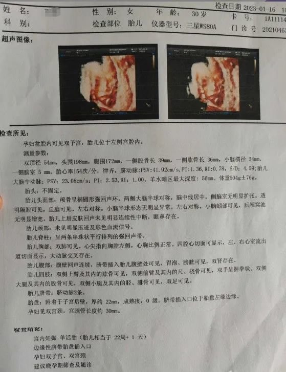 罕见！妊娠合并双子宫、双宫颈、双阴道_凤凰网健康_凤凰网