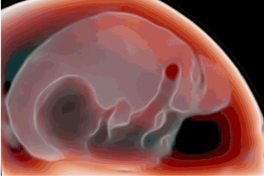 迈瑞有什么产品迈瑞医疗多款高端产品应用AI黑科技_https://www.jmylbn.com_新闻资讯_第2张