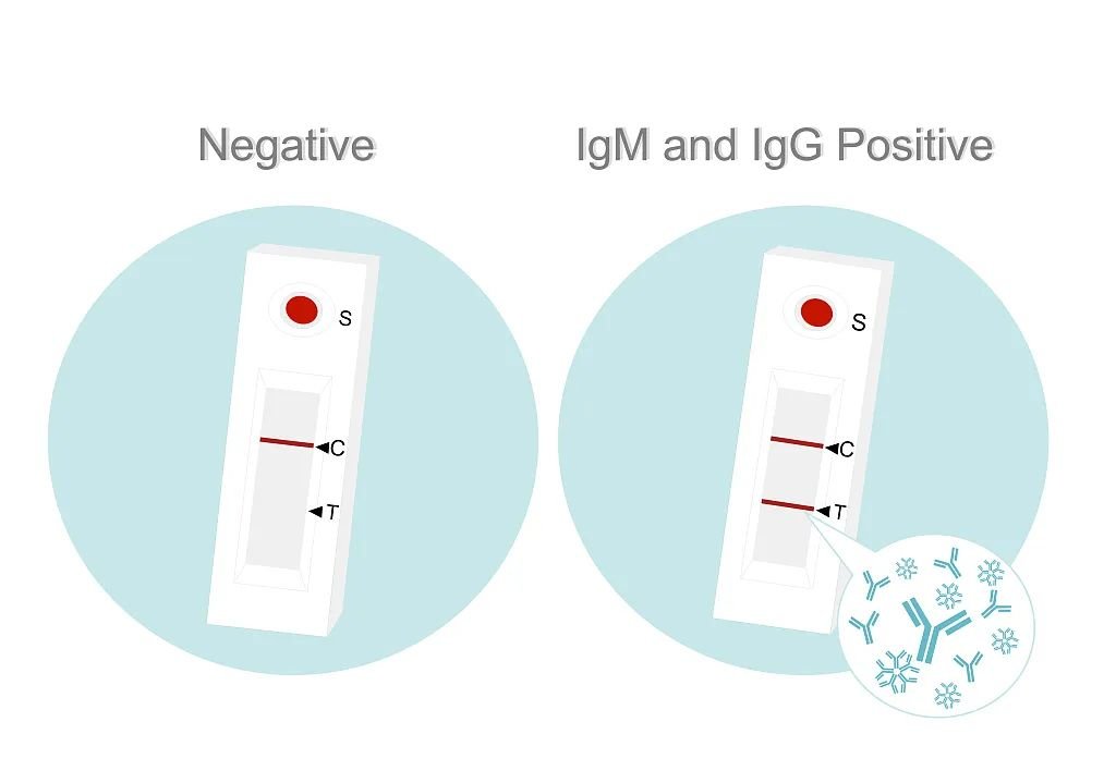 抗体(IgM和IgG)快速检测试剂盒/视觉中国