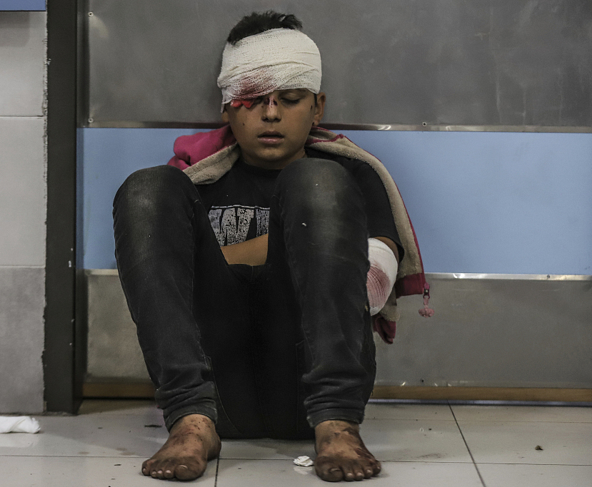 当地时间2023年10月17日，以色列对加沙发动空袭后，受伤的儿童被包扎。