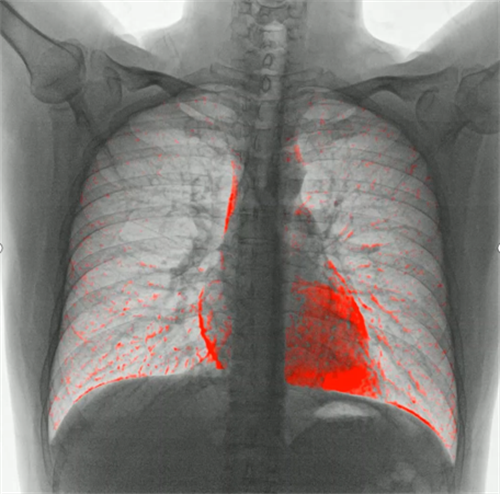 x射线为什么叫dr2023年新技术浪潮下的DR技术趋势_https://www.jmylbn.com_新闻资讯_第6张