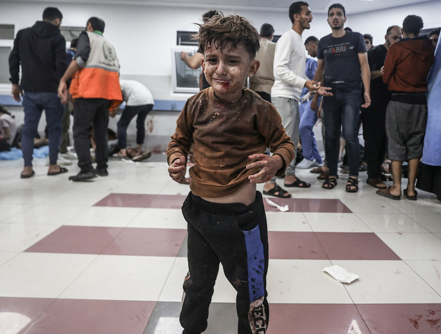 当地时间2023年10月17日，以色列炮击加沙当地医院后，一名受伤的儿童站在人群中。