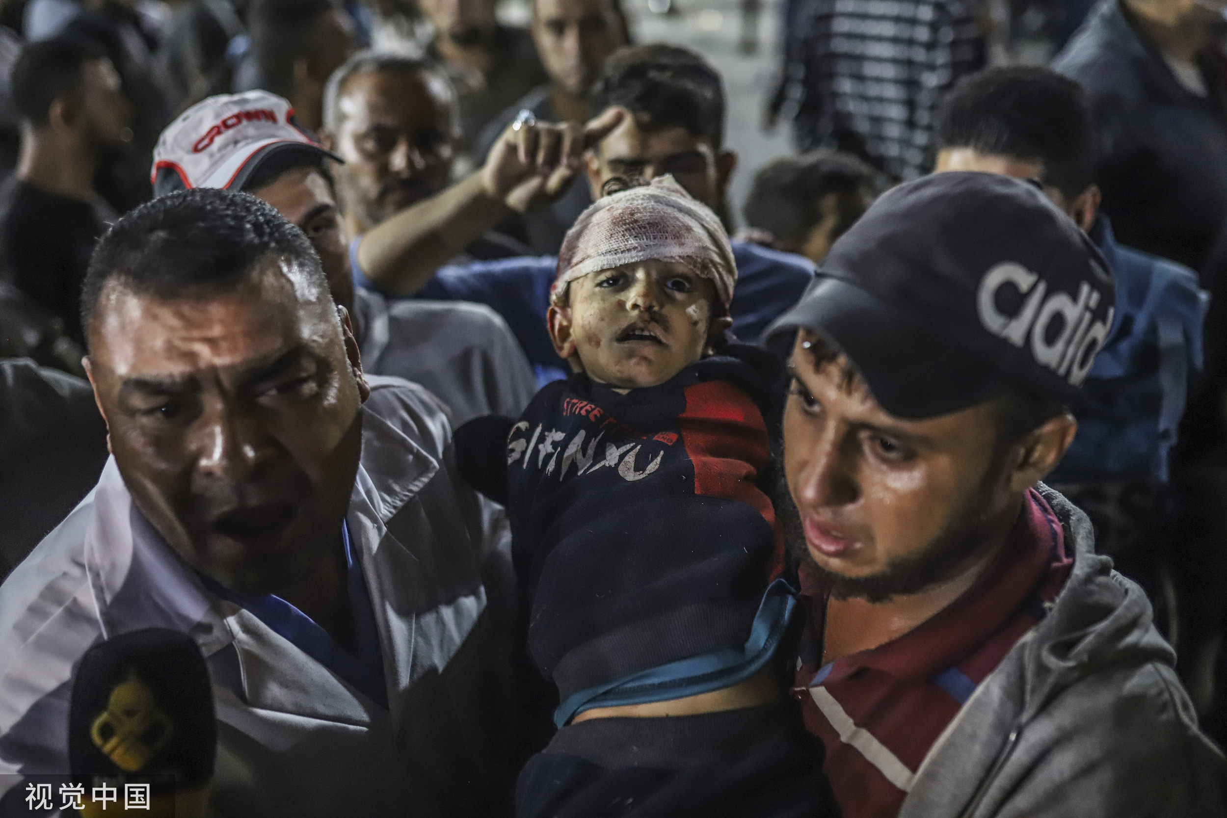 当地时间2023年10月17日，加沙城，巴勒斯坦人将一名受伤儿童抬到加沙城的医院。