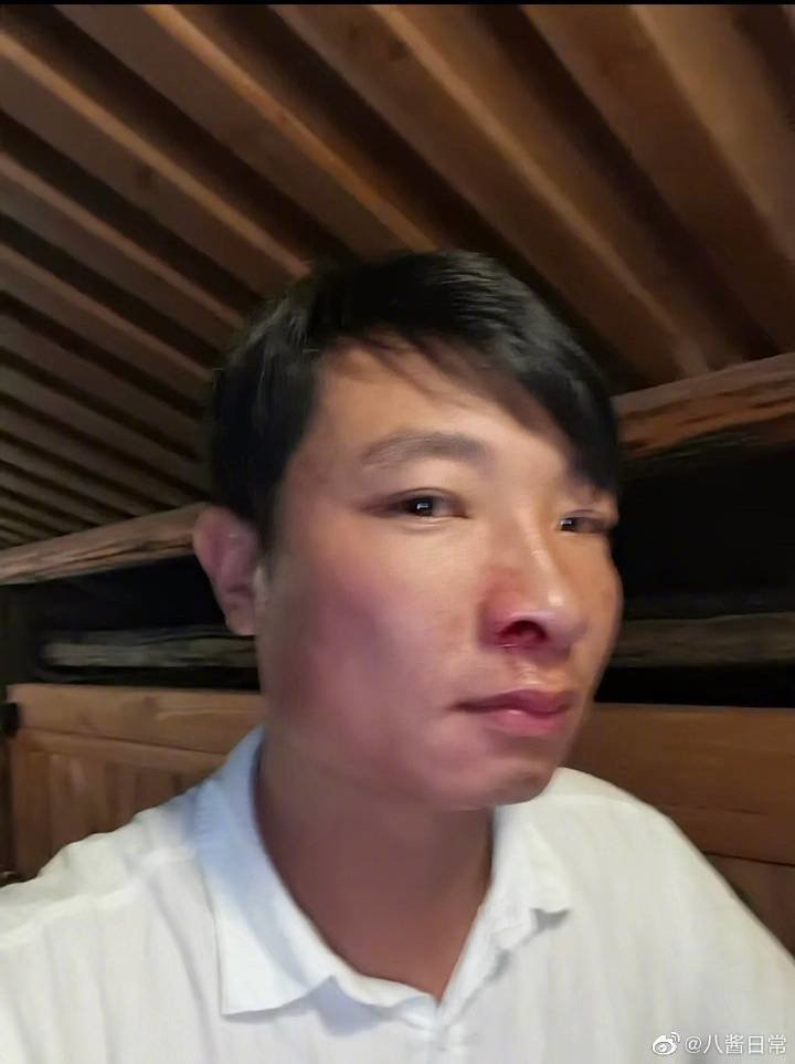 ▲杨槠策打完自己后的样子