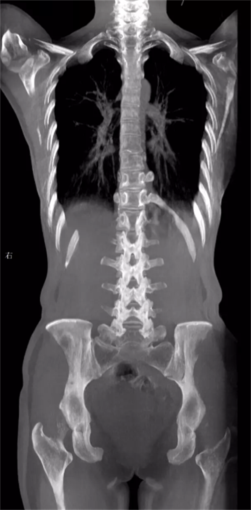 x射线为什么叫dr2023年新技术浪潮下的DR技术趋势_https://www.jmylbn.com_新闻资讯_第3张