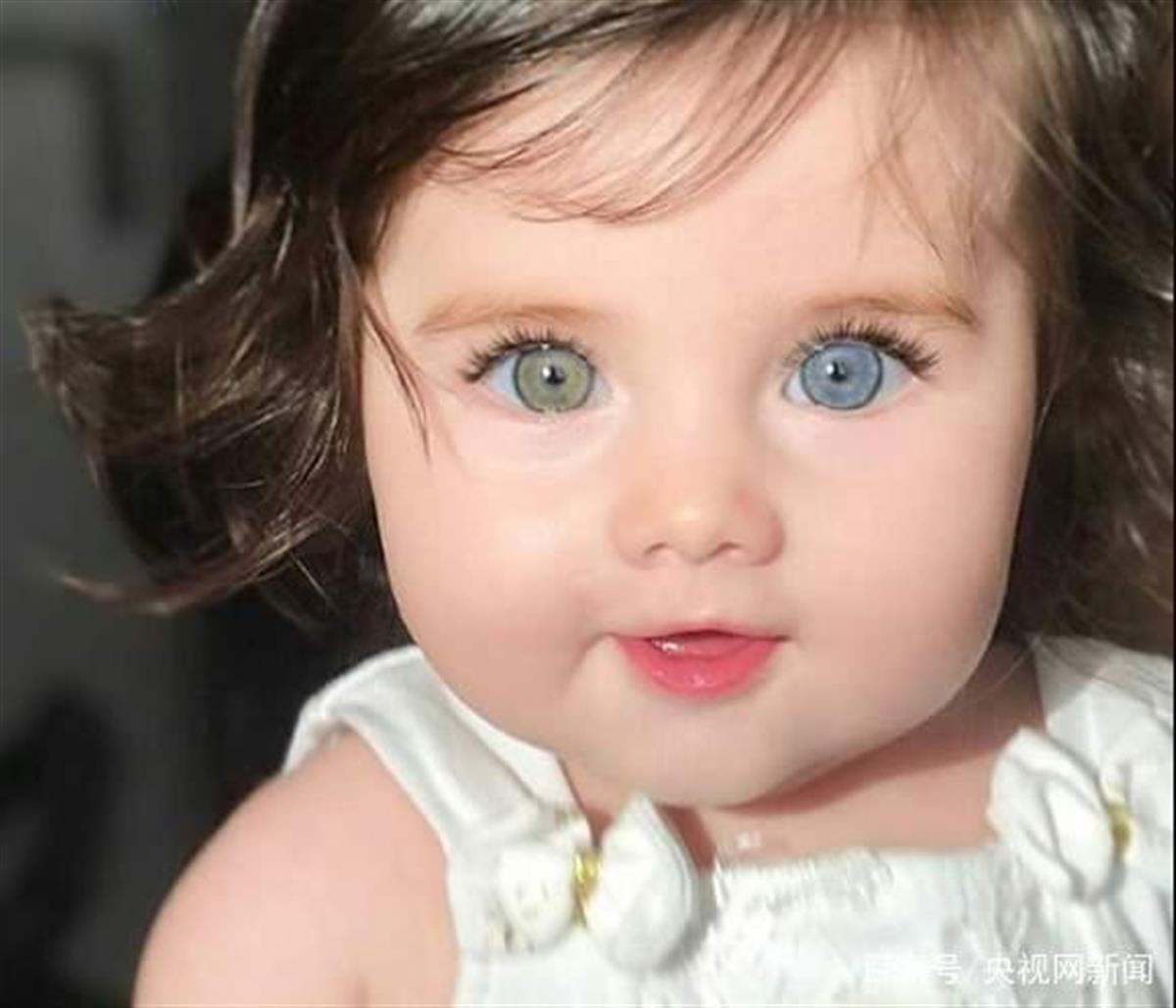 江西一女孩右眼蓝色被赞“眼里有星辰大海”，世界上还有人眼睛是绿色的, image size:1200x1029