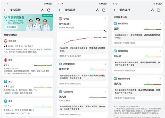 2023智能手表ZDC报告:头部竞争引领技术革命,价格两极分化