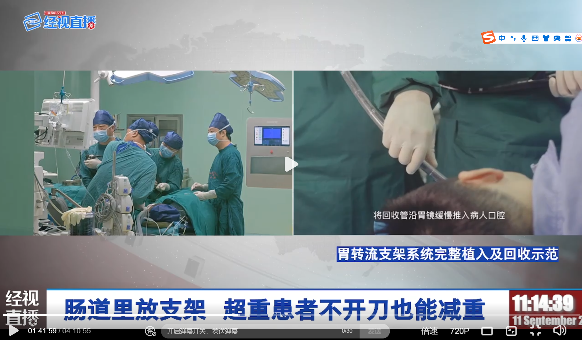 手术过程(左)与示范(由)。图 经视直播.png