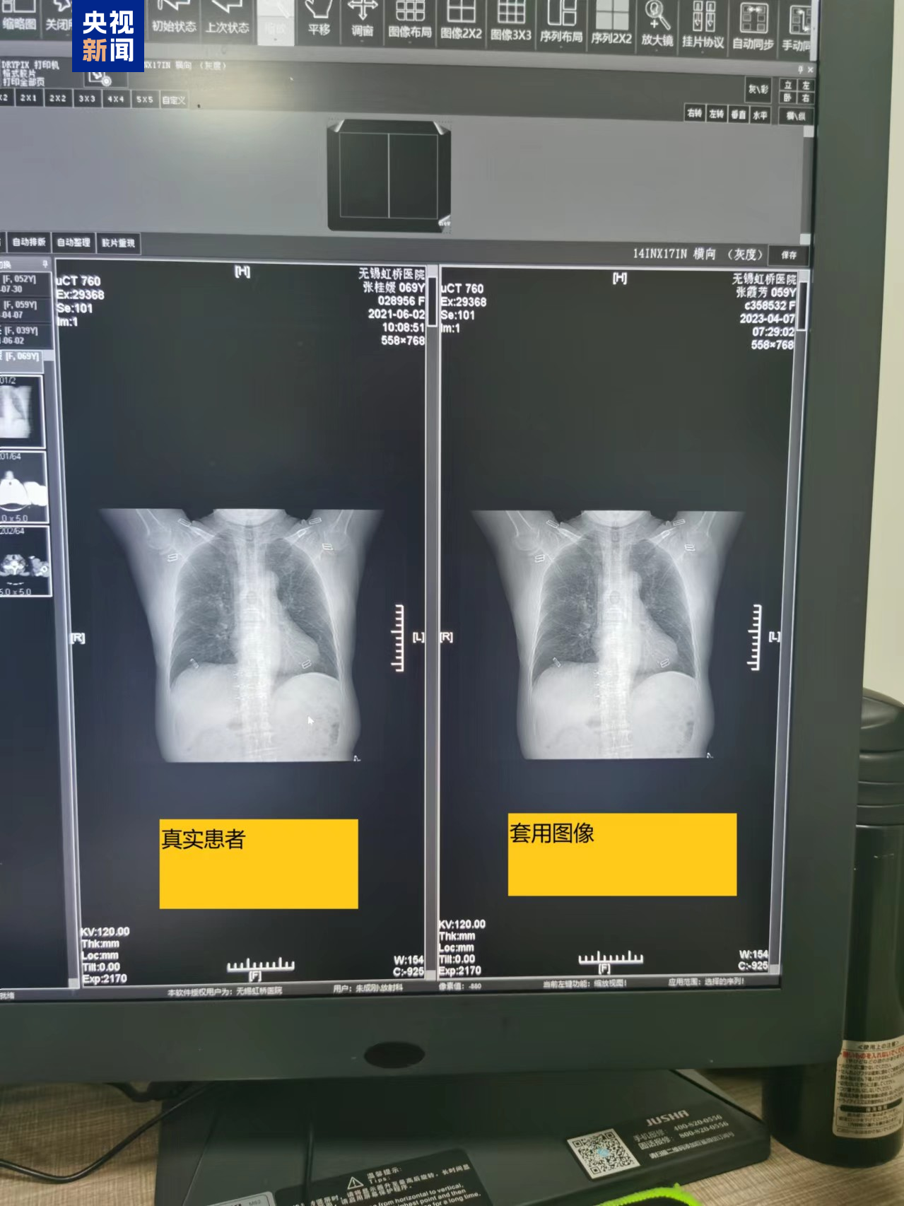 团伙式作案、全链条造假、恶意对抗调查，国家医保局通报无锡虹桥医院调查情况