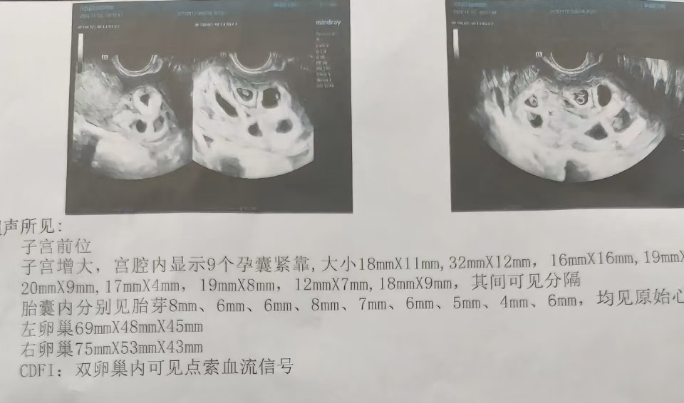 侯女士的检查单。来源:当事人社交媒体账号