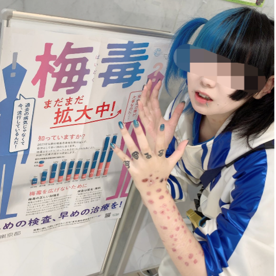 图9 X推文中右图