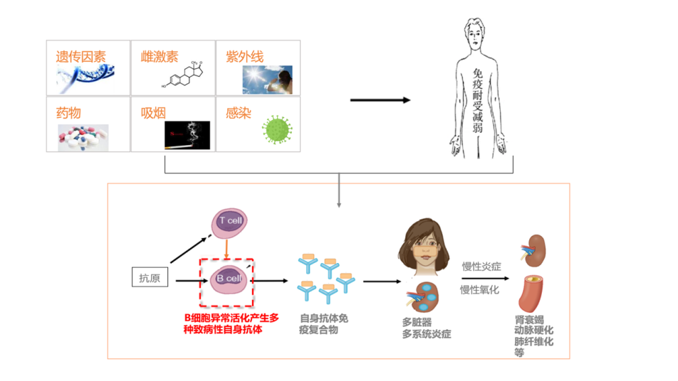 系统性红斑狼疮，拿什么拯救你？