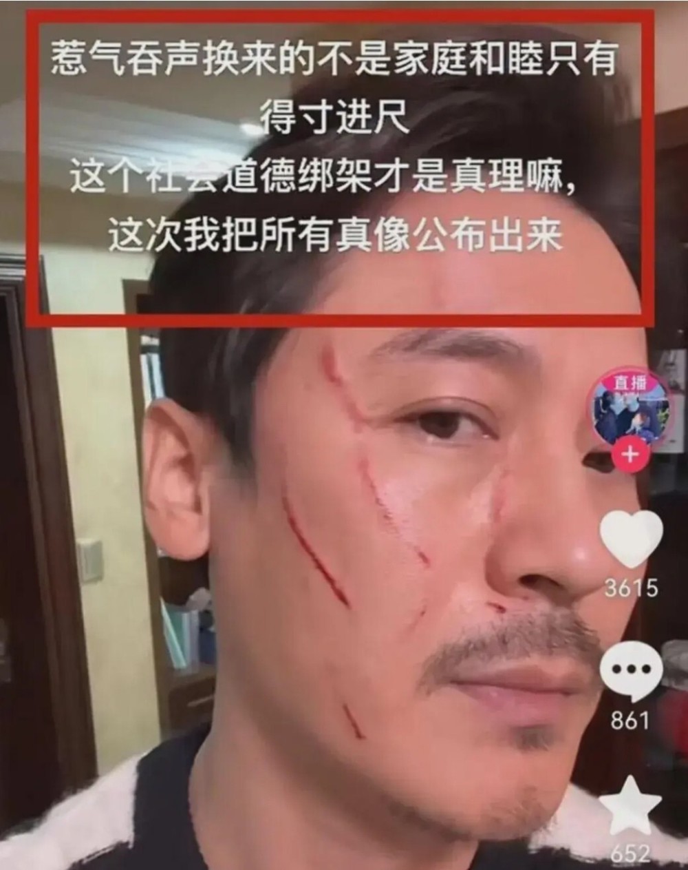 王东回应妻子在救助站过年，怒斥妻子撒谎成性，一切都为了博流量 - 吾爱微网