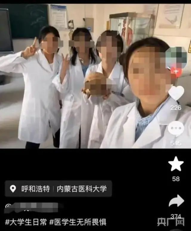 医学生和大体老师头骨微笑合影被骂，冤吗？