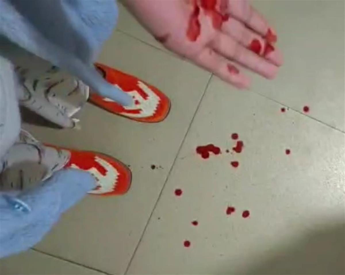 杨女士被打出鼻血