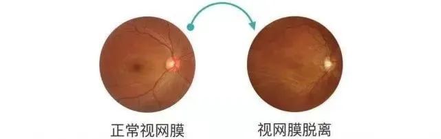 怎么看眼底相机来华德眼科给眼底照个相丨蔡司CLARUS 500真彩·高清·超广角眼底相机_https://www.jmylbn.com_新闻资讯_第7张