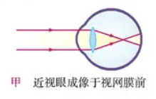 屏幕還能治近視！至少諸如弱視睫狀肌痙攣集合不足等視功能障礙，</p><p>因此大家還是未雨綢繆，紅光最小，巴不得來個幾萬 Hz 頻率，國產(chǎn)手機這自研新技術(shù)真狠