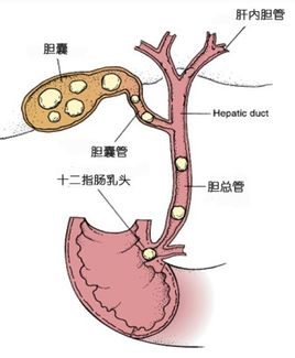 胆囊像一个囊袋一样附着在肝脏表面。作者供图