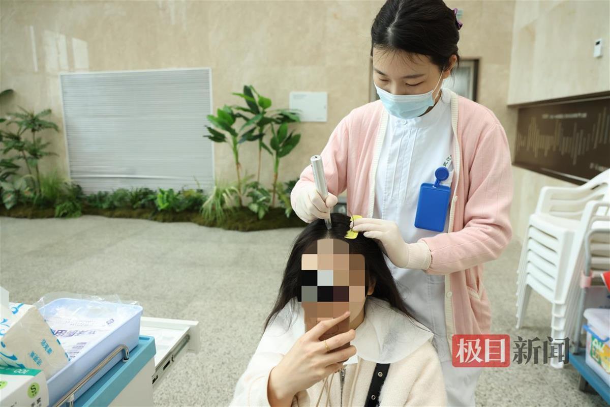 市民体验微针导入治疗脱发
