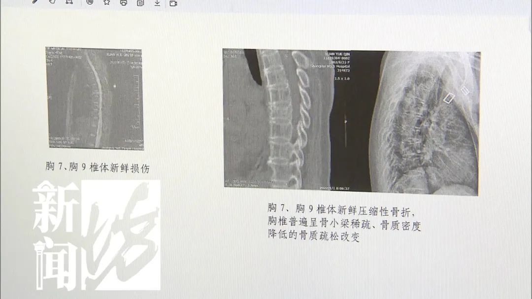 女子救护车上受伤骨折，九级伤残！责任谁担？法院判了