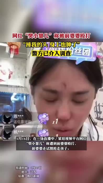 千万粉丝网红“樊小慧儿”称被前婆婆殴打#热点知多少