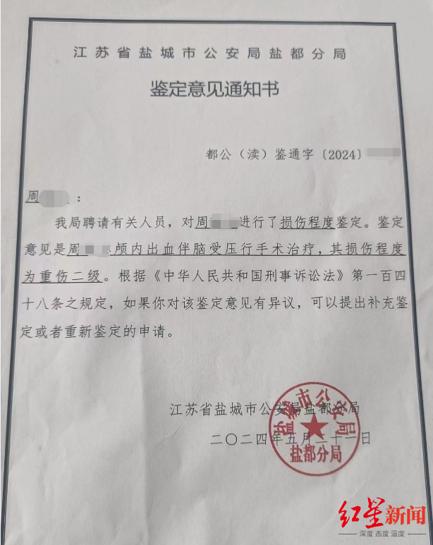 13岁住校生被同学殴打致颅内出血，警方：已刑事立案，仍在侦查阶段